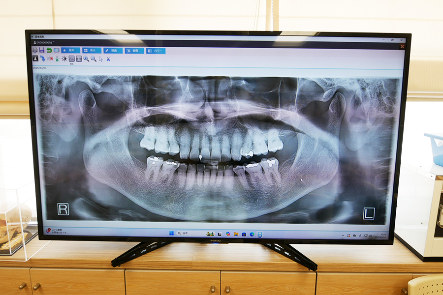 わかりやすい説明と納得の治療